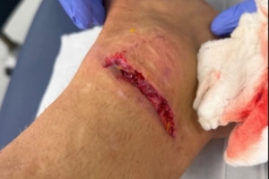 丹索：迪涅在場邊我向他道了歉，確實碰到了他，但我明顯先清了球