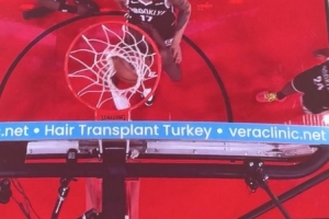 問啥詹姆斯！NBA籃板上沿有土耳其植發(fā)公司廣告 手動@杰倫-布朗