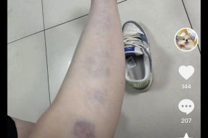 涉及籃球女主播？解說員孔祥宇妻子社媒曬家暴痕跡&申請離婚