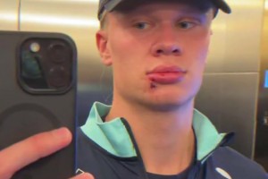 嘴角縫了三針！哈蘭德被大巴車門撞破臉，現(xiàn)場(chǎng)大喊：Fxxk